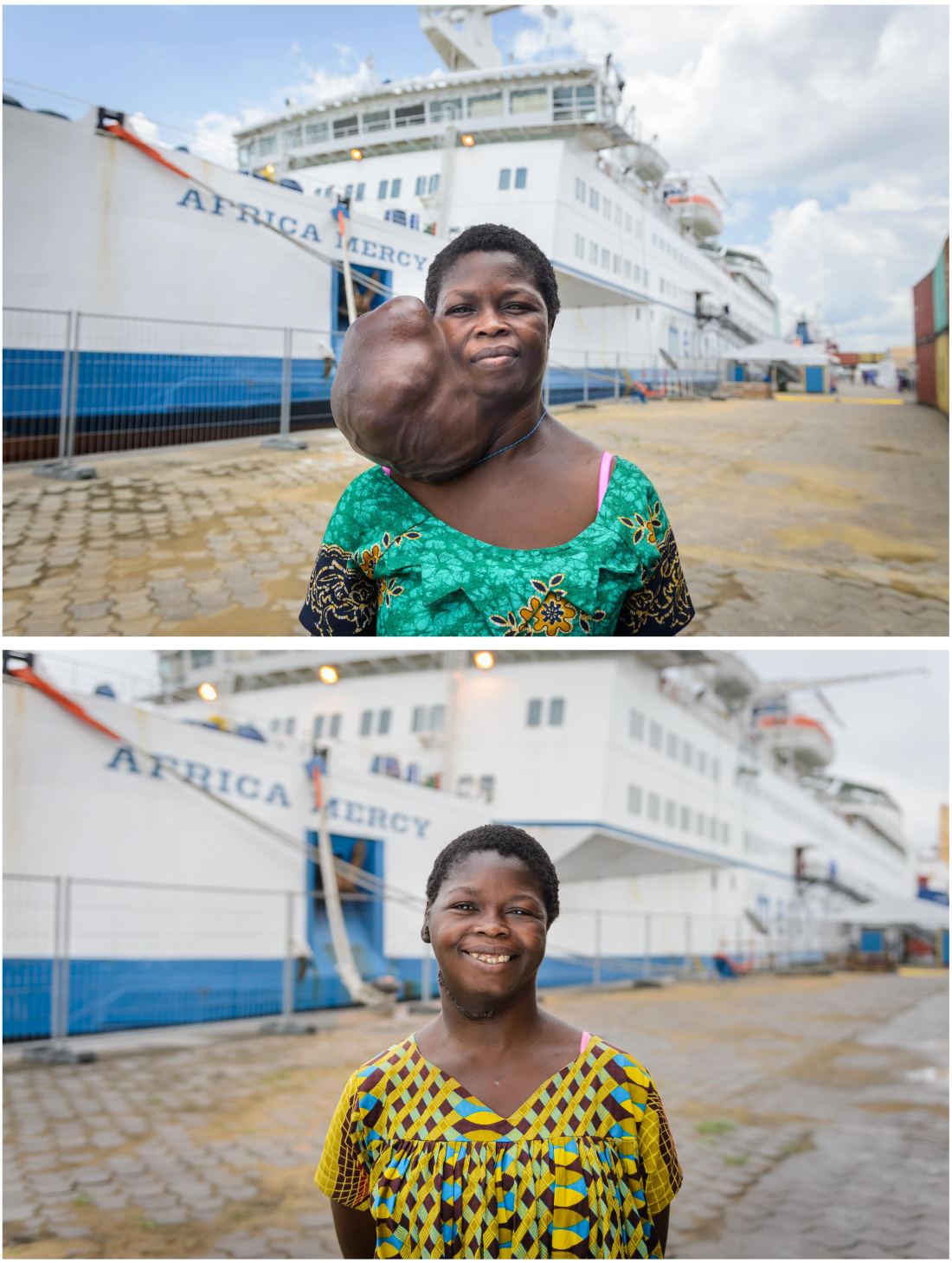 valerie-before-and-after